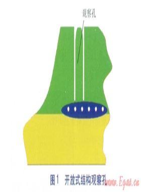 燃氣聚乙烯管道電熔連接兩個典型問題分析